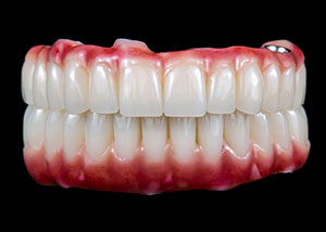 permanent-zirconia-teeth-double-arch-cover
