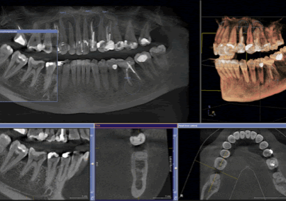 3D CONE BEAM CT IMAGING