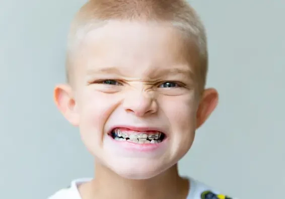 Early Orthodontic Treatment for Children